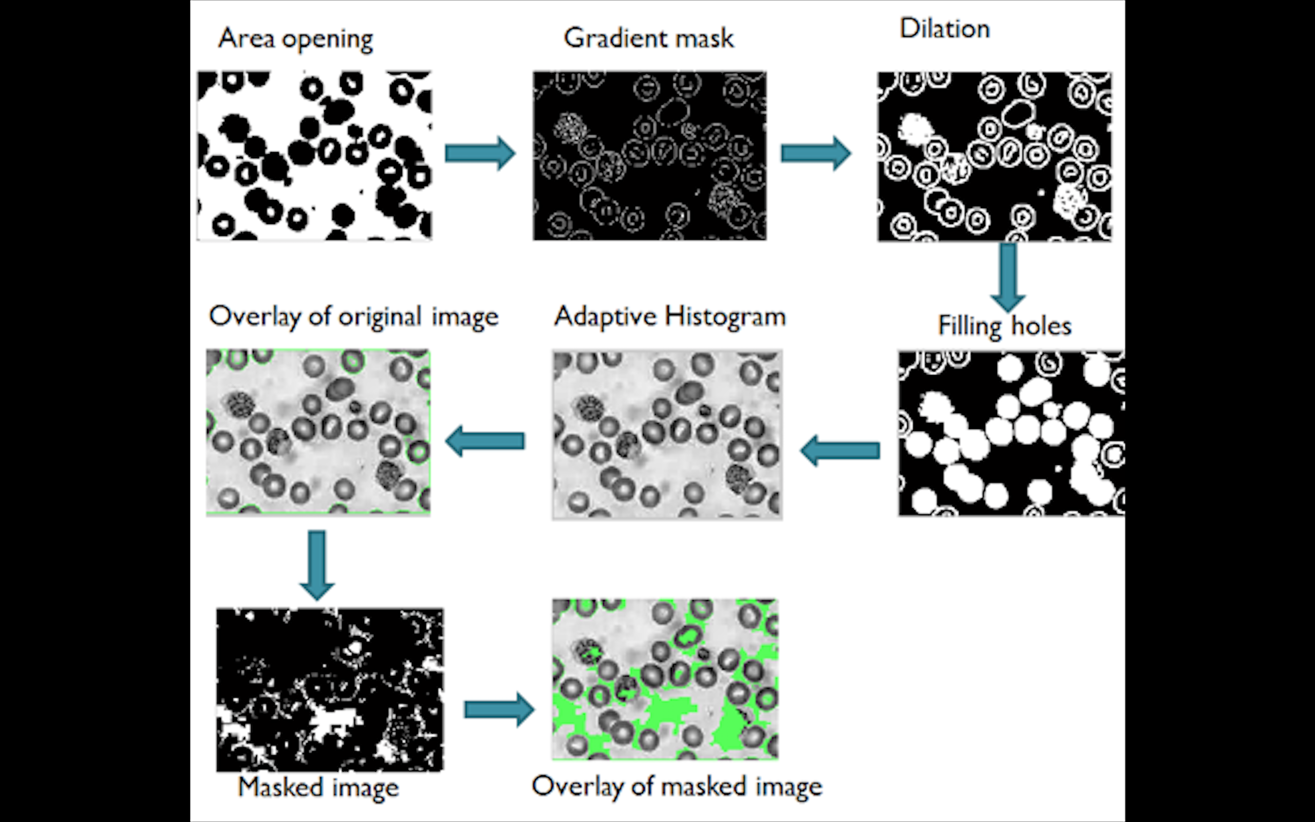 Automated Parasite Detection